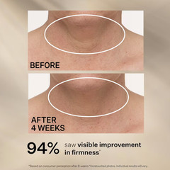 BigSALE ~ StriVectin TL Advanced Tightening Neck Cream Plus, 1.0 oz ~ New 100%