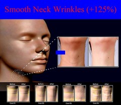 SCM (85%) & PDRN + Milk Exosome Skin Regeneration Meso-Therapy Ampoule