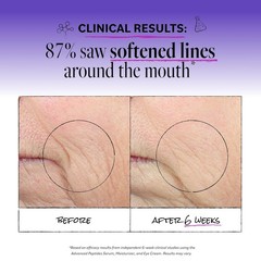 2 oz and Cruelty-Free Night Moisturizer – Smooths Fine Lines & Wrinkles