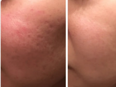 Majestic Skin – 20% Human Stem Cells Regenerative Serum from Japan 5ml