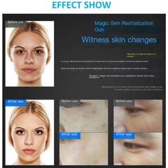 Professional Frozen Gun Manual Facial Skin Lift Skin Rejuvenation Machine