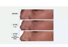 NEW Nakery Beauty Lift-TOX 360 Firming Eye Lift Treatment Cream 1.01 Fl Oz