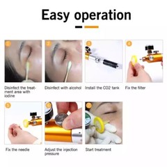 Portable CDT Carboxiterapia Carboxy Therapy Device Stretch Eye Wrinkle Removal