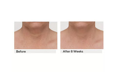 StriVectin TL Advanced Tightening Neck Plus Cream, 1 oz