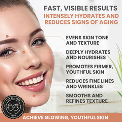 Alozera Vitamin C Face Cream – Brightens, Hydrates & Firms, 1.7 oz