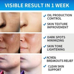 Glycolic Acid 35% Facial Exfoliating Peel Pads AHA Green Tea – 50 pads USA Stock