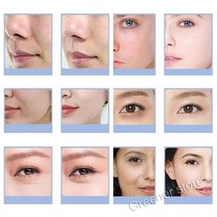 Glam Pod for Aqua Facial Machine CO2 Pods Bubble Skin Care Revive Capsules Gel