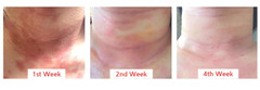 SCM (85%) & PDRN + Milk Exosome Skin Regeneration Meso-Therapy Ampoule