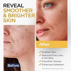 Vitamin C Serum for Face with Stem Cells Hyaluronic Acid Vitamin E Aloe Vera For