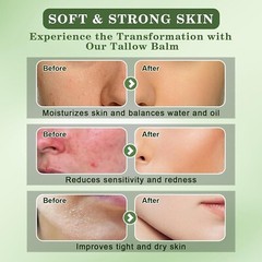 Beef Tallow and Honey Balm for Skin, All-Natural Moisturizer, Hydrates and No…