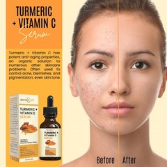 4 FL OZ – TURMERIC FACE SERUM PURE + VITAMIN C & HYALURONIC ACID, ORGANIC