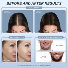 Microneedle Derma Stamp – Microneedling Micro Needling for Face Body