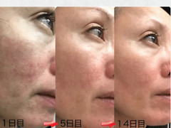 Majestic Skin – 20% Human Stem Cells Regenerative Serum from Japan 5ml
