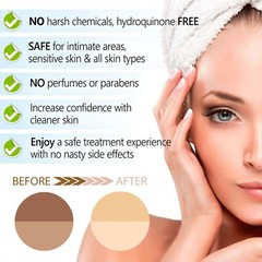 KOJIC ACID Skin Whitening Lightening Brightening Serum Bleaching/Spot Fade Cream