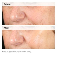 The Ordinary Authentic Alpha Arbutin 2% + Hyaluronic Acid Standard Or Value