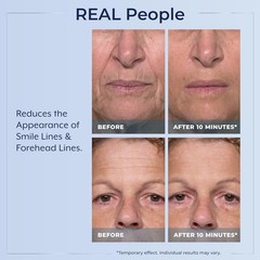 1-3X Plexaderm Rapid Reduction Eye Serum,Visibly Reduces Under-Eye Bags,Wrinkles