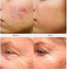 2 PK Retinol, Niacinamide Vita C Hyaluronic Acid Collagen Wrinkle SERUM + CREAM