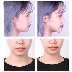 120PCS Invisible Face Lifter Tape Instant Face Lift Tape Double Chin Wrinkles