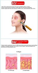 Portable CDT Carboxiterapia Carboxy Therapy Device Stretch Eye Wrinkle Removal
