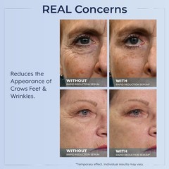 Plexaderm Rapid Reduction Eye Serum – Visibly Reduces Under-Eye Bags, Wrinkles~