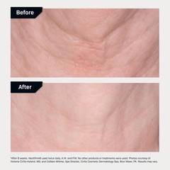 Nectifirm Advanced Neck Cream – Clinically Proven to Firm, Lift & Contour the…
