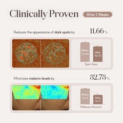 SCM (85%) & PDRN + Milk Exosome Skin Regeneration Meso-Therapy Ampoule