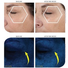 MICHAEL TODD Beauty KNU Cream Face Lifting, Brightening & Tightening Cream fo…