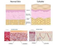 CELLULITE REMOVAL COMPLEX FOR FACIAL & BODY ~FIRM / FLAT / SMOOTH SKIN