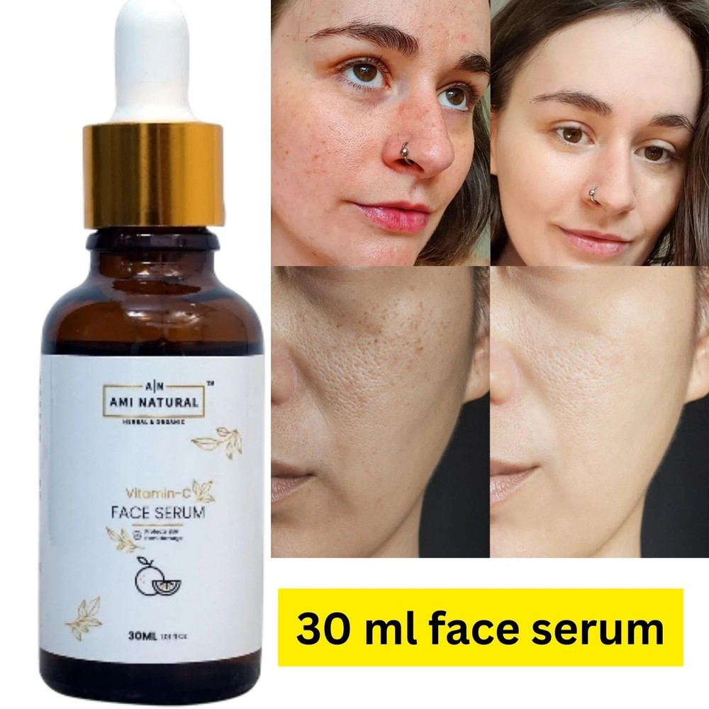 Ami Natural Vitamin C Face Serum for improve skin texture and glow – 30 ml