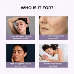 Dr Sakhiya Acne Night Cream Retinol Niacinamide Salicylic Acid 50g Oily Skin
