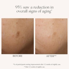 Exuviance AGE REVERSE+ Advanced Renewal Retinol Serum 2642065
