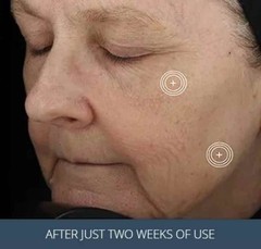NEW TNS Advanced + Serum For All Skin Types 1 Oz/28.4g EXP 10/27 USA SHIP