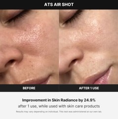 Medicube AGE-R ATS AIR SHOT Microneedle Therapy Home Skin Care Device NEW!!!