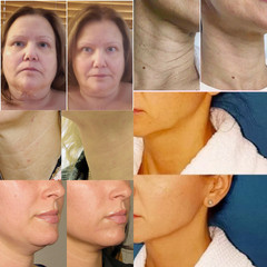 Advanced Tightening Neck Cream For Lift Sagging Skin Anti-Aging Rejuvenation