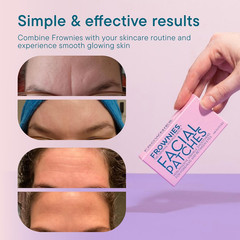 Forehead and between the Eyes Wrinkle Patches – Hypoallergenic Facial Patches to