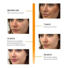 Matrixyl 3000 Peptide Hyaluronic Acid Retinol Collagen AntiAging Vitamin C Cream