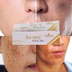 Wheezal Mel-X Melasma Cream melasma, chloasma, and premature aging (25g)