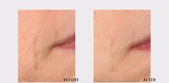DIY 100% Argireline Copper Peptide Solution Booster + Matrixyl 3000, SNAP-8,