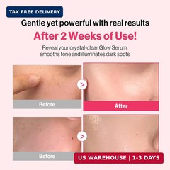 [Redence] Dark Spot Corrector Serum with 5% Niacinamide & Vitamin C | Tone & Spo