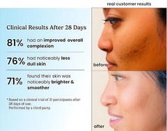 Timeless 20% Vitamin C Face Serum for Skin Brightening, Dark Spot & Blemish 30ml