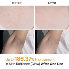Dr. Melaxin Peel Shot Exfoliant Kojic Acid Turmeric Spray 200ml Brand new