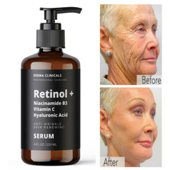 Retinol, Niacinamide, Vitamin C, Hyaluronic Acid, AntiAging Wrinkle SERUM – 4oz
