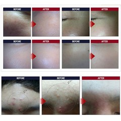 KOREA BEST SKIN CARE Whitening Cream + Snail Cream + Collagen Cream Moisturizer
