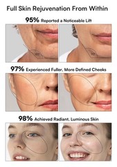 INIA 3in1 Skin Tightening Device True Beauty Glow Facial Massager Red Light T…