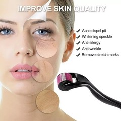 0.5mm 1mm 1.5mm 2.0mm 540 Microneedle Scar Derma Roller Dermaroller