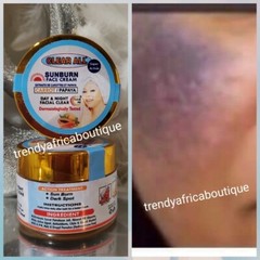 Clear all sun burn face and under eye cycle face cream . Carrot & papaya x 1 jar