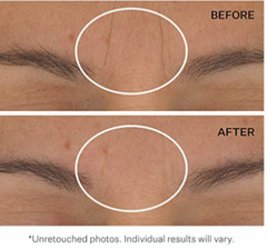 DISCONTINUED StriVectin Star Light Advanced Retinol Night Oil 1 oz SOLD OUT