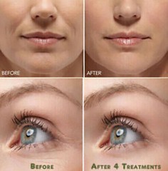 HYALURONIC ACID 100% Pure Anti Aging Hydrating Serum, Plumps Wrinkles Fine Lines