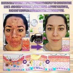 1-3PCS Biotin 10-in-1 Skin Restoration Cream, 2026 New Skin Treatment Cream ~HOT
