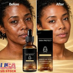 Skin Protect Serum Black Women Gentle Facial Skin Care Moisturizing Serum